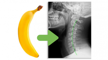Blog Post Header - ideal neck curve looks like a banana
