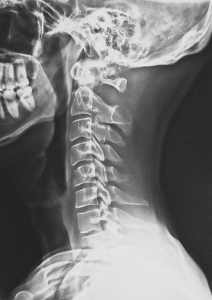 Norwest Chiro Benfits of Xray 01