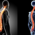 Spinal Curves: What is the ideal shape of the spine?